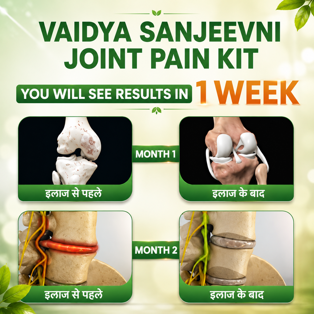 7 Days Result Joint Pain Relief Kit (28 Herbs) + Diet Chart and Doctor Consultation (FREE)