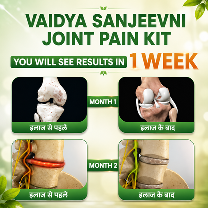 7 Days Result Joint Pain Relief Kit (28 Herbs) + Diet Chart and Doctor Consultation (FREE)